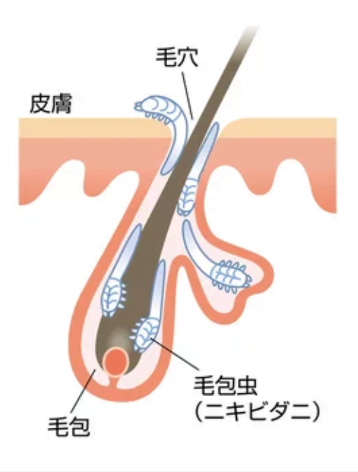 毛包虫（ニキビダニ）症について